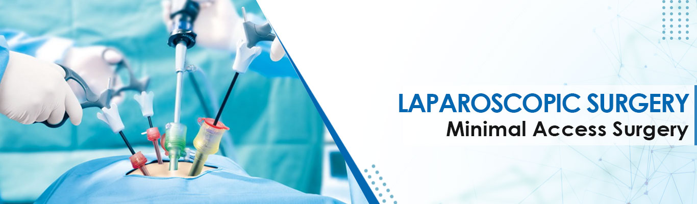 Laparoscopic Surgery (Minimal Access Surgery)